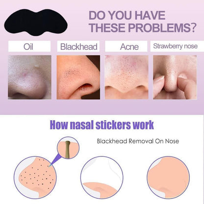 Deep Cleansing Blackhead Remover Strips (Pack of 10) bqu5q7-dm