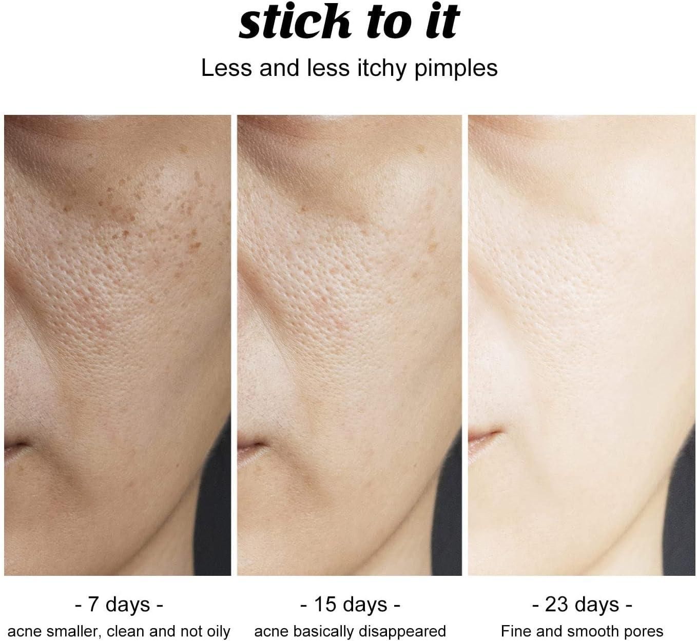 Charcoal Cleansing and Deep Face and Soap Natural Bath Skin bqu5q7-dm