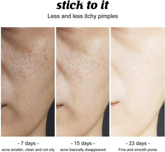 Charcoal Cleansing and Deep Face and Soap Natural Bath Skin bqu5q7-dm