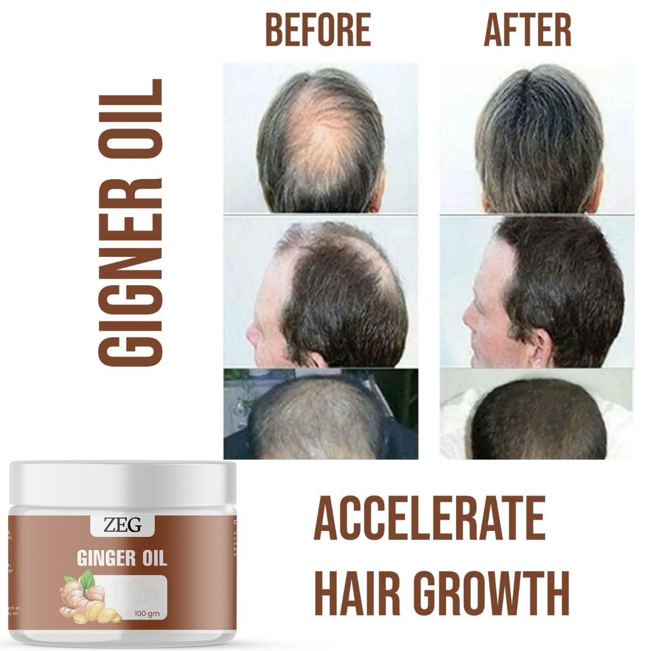 ZEG GINGER OIL 100GM ? 100% Natural Multipurpose Oil for Hair, Skin & Body bqu5q7-dm