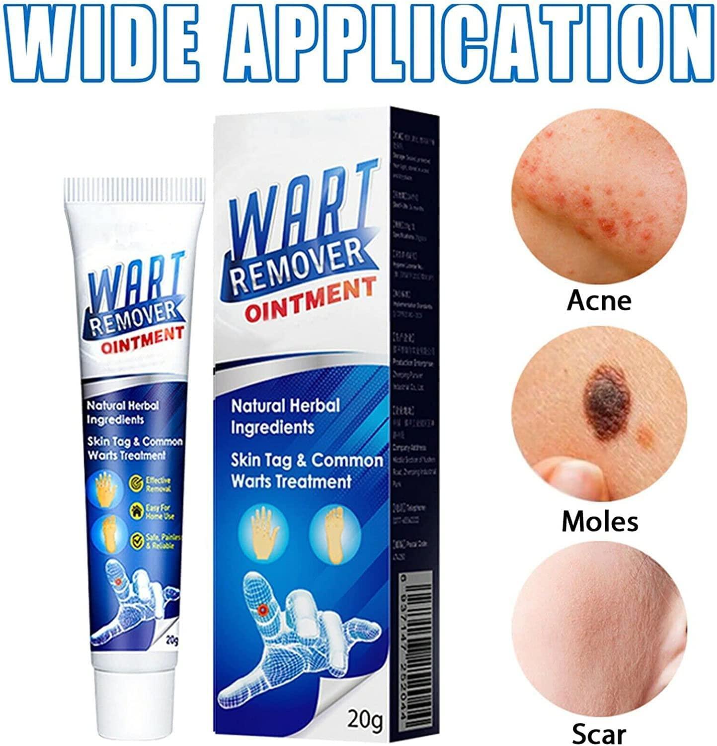 WartsOff Instant Blemish Removal Cream Warts Off Instant Blemish Removal Cream 20 g Wart Remover Ointment for All Skin Types (Pack of 1) bqu5q7-dm