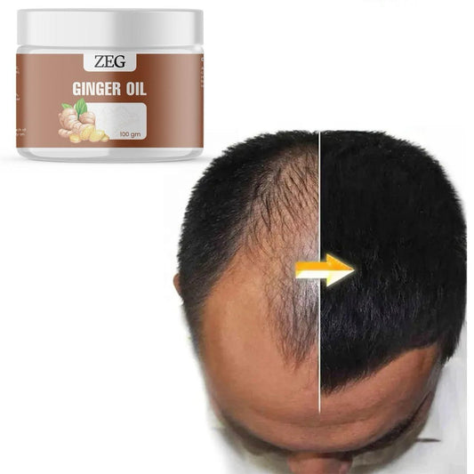 ZEG GINGER OIL 100GM ? 100% Natural Multipurpose Oil for Hair, Skin & Body bqu5q7-dm