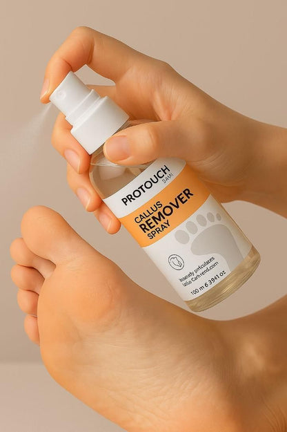Callus Remover Spray 100ml bqu5q7-dm